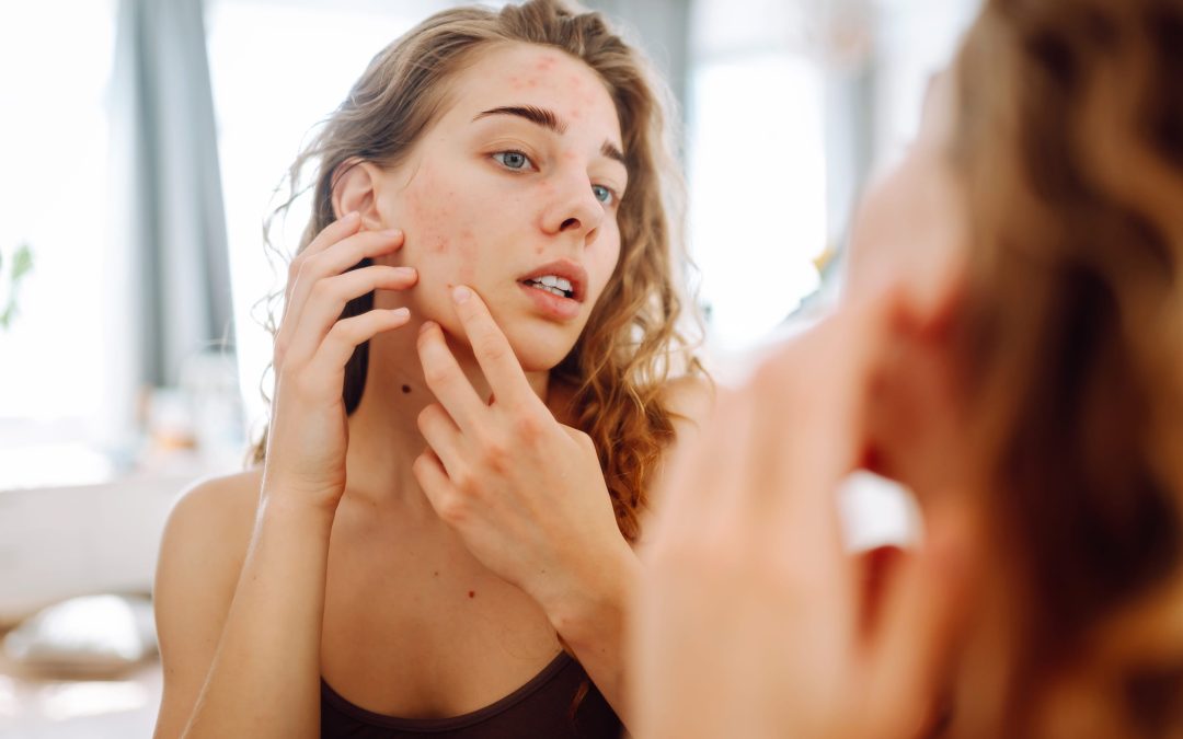 Best Pillowcase for Acne: Skin-Friendly Guide